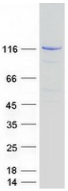 Coomassie blue staining of purified JAK1 protein.